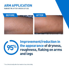 Load image into Gallery viewer, CeraVe Intensive Moisturizing Lotion for Dry to Very Dry Skin, 95% improvement before and after